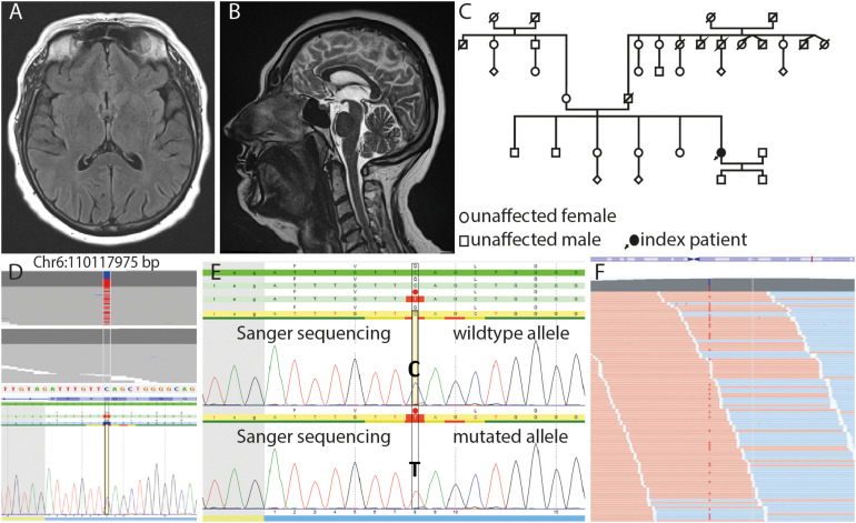 FIGURE 1