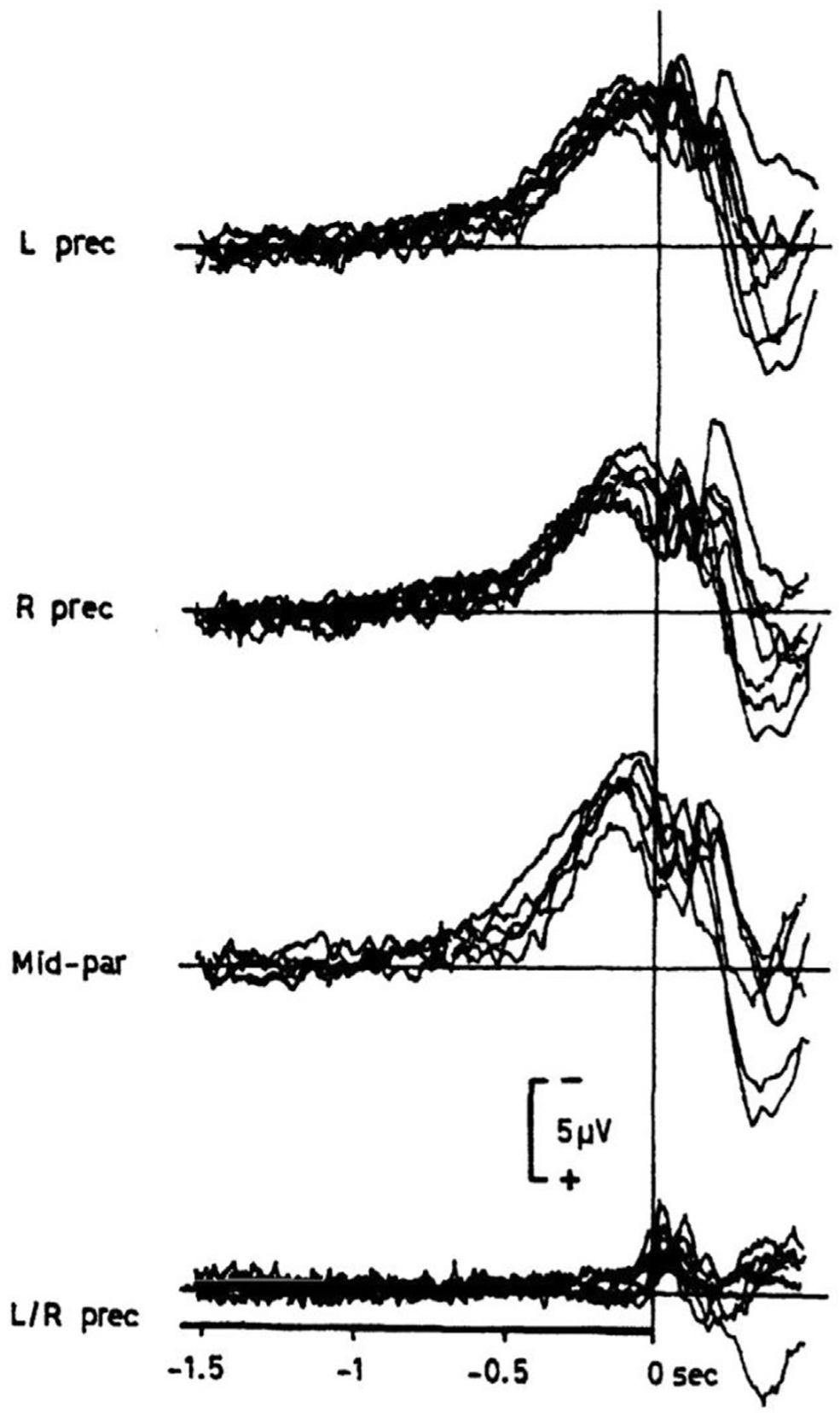 Fig. 16.