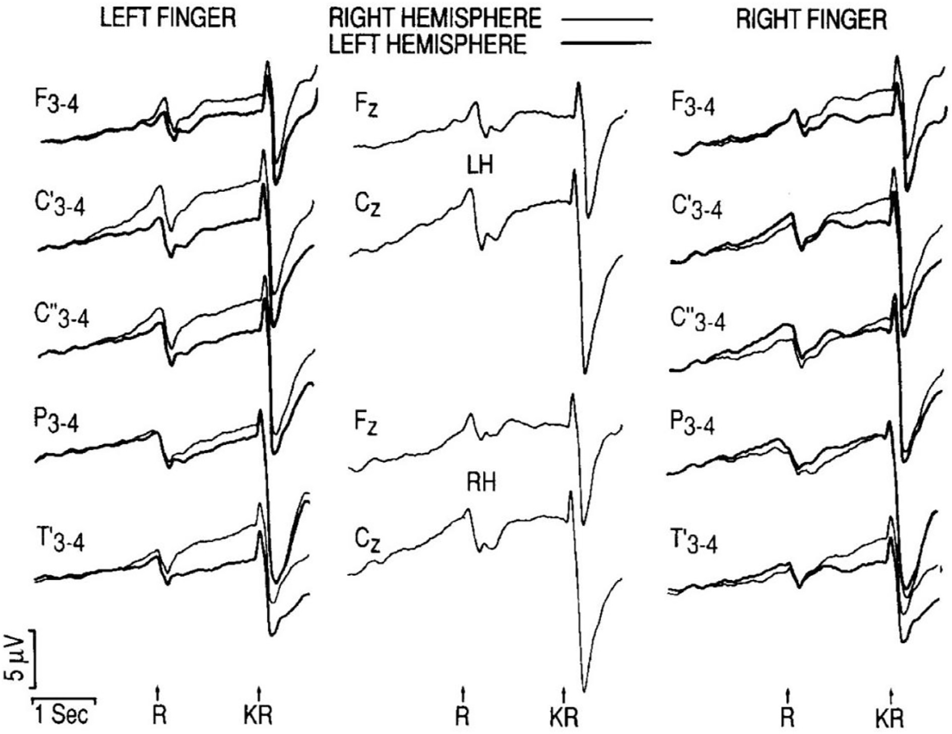 Fig. 19.