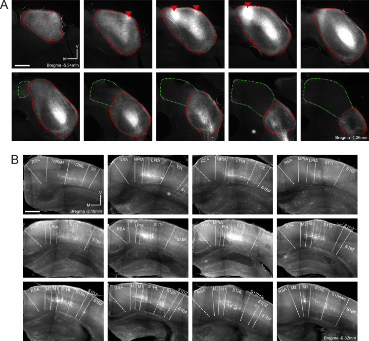 Figure 2—figure supplement 3.