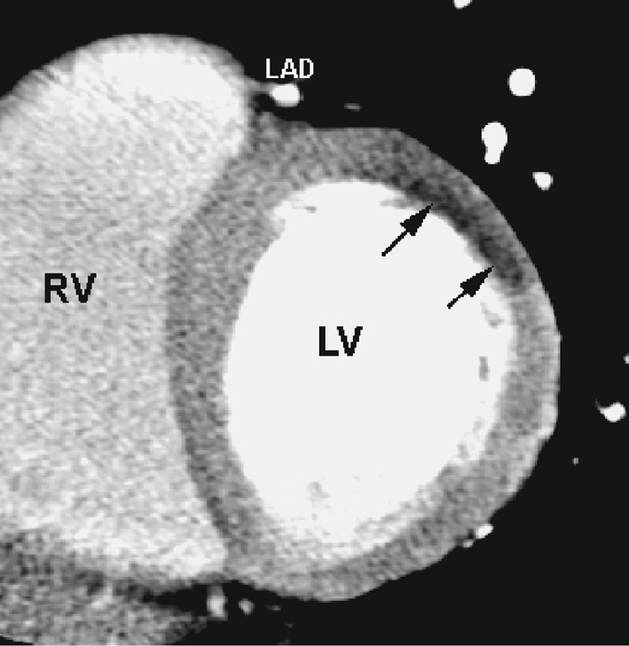 Fig. 4