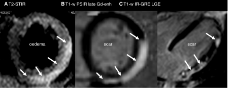 Fig. 2