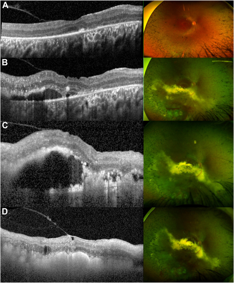 Figure 2