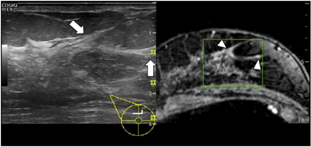 Figure 14.