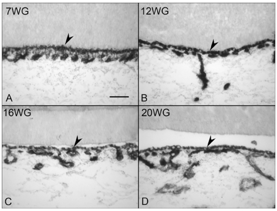 Figure 11