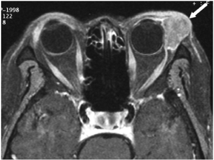 Fig. 17