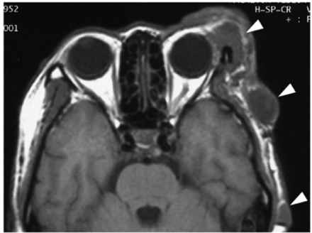 Fig. 16