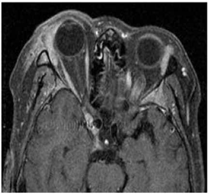 Fig. 14