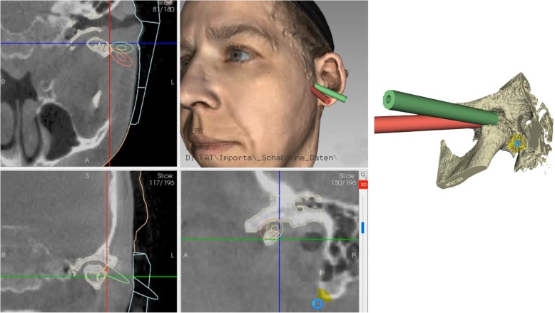 Fig. 1