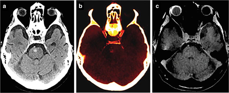 Fig. 1