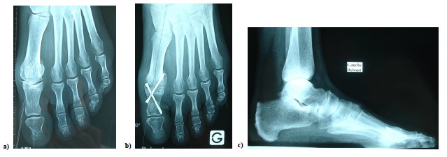 Fig. (7)