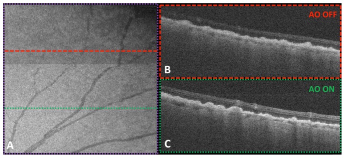 Fig. 11