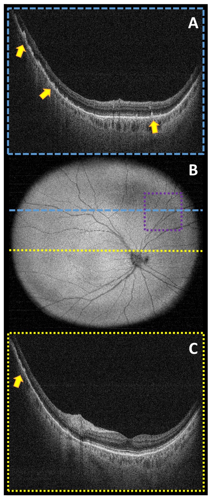 Fig. 10