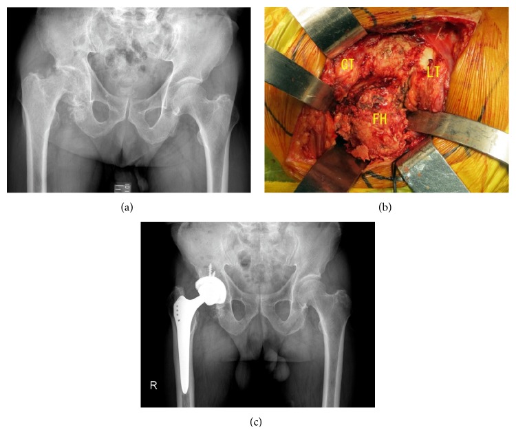 Figure 4