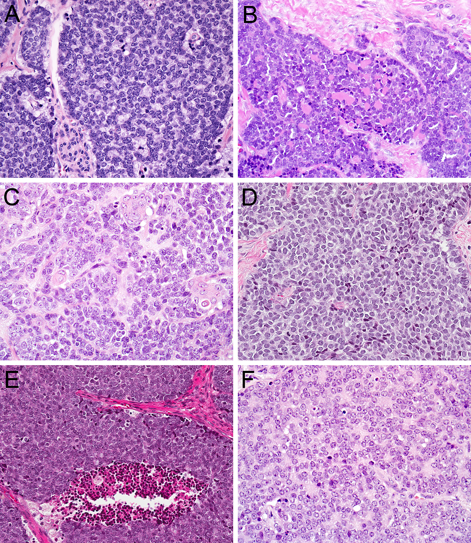 Figure 2: