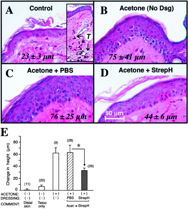 Figure 4-4256