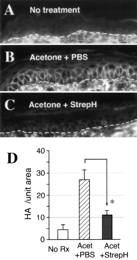 Figure 3-4256