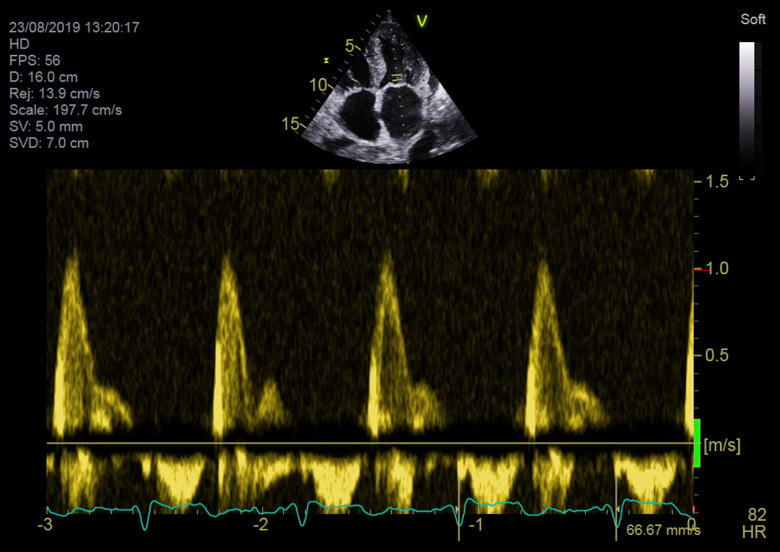 Figure 7.