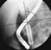 Fig. 2