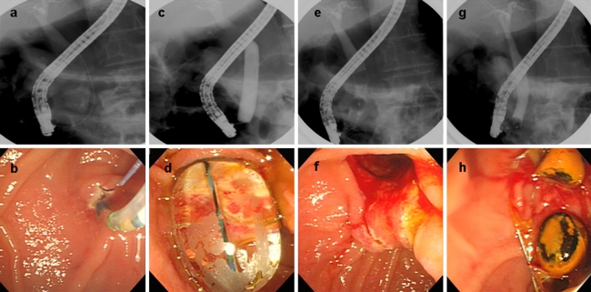 Fig. 1a–h