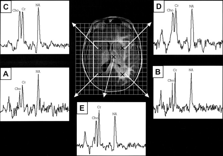 Fig 3.