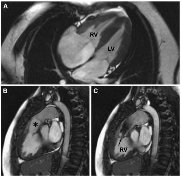 Fig 3