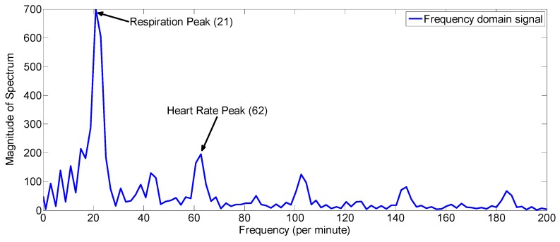 Figure 17