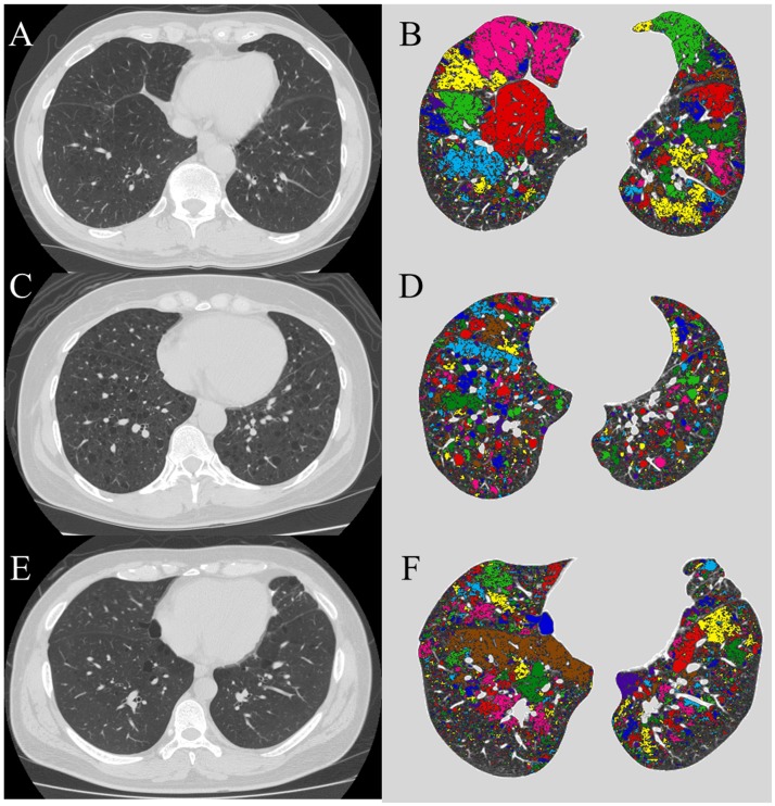 Fig 1