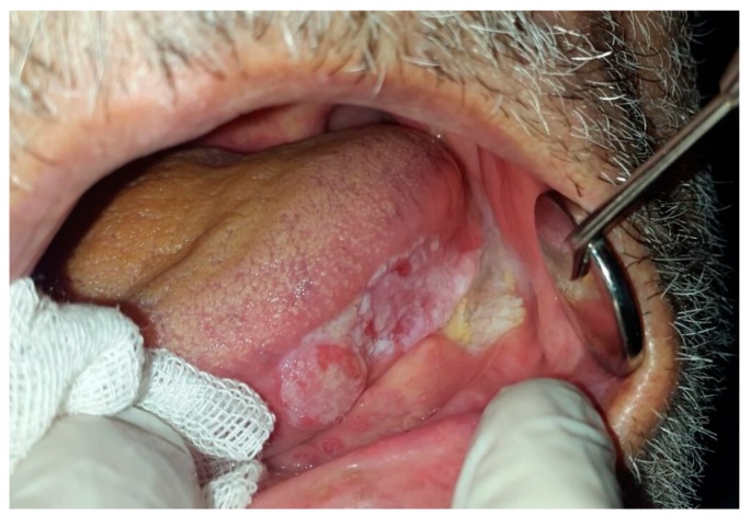 Figure 11