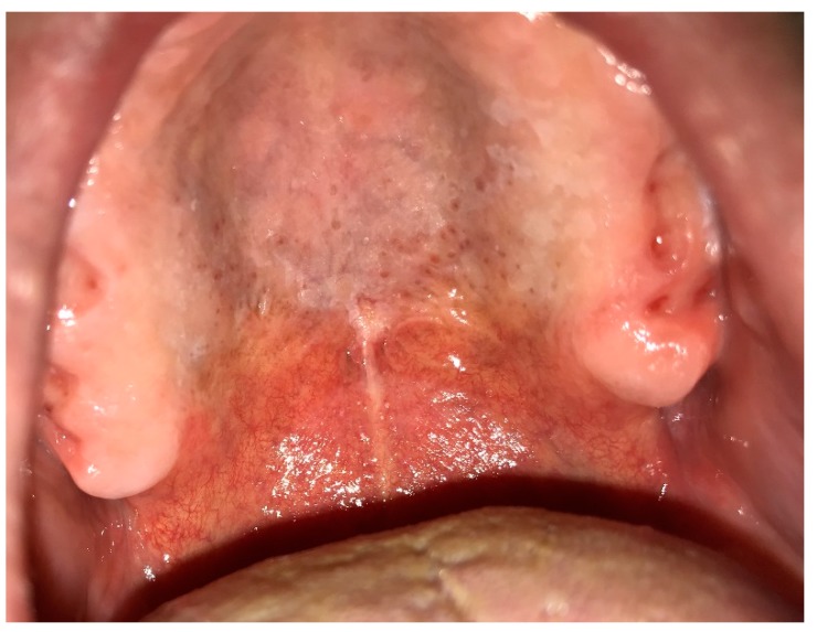 Figure 12