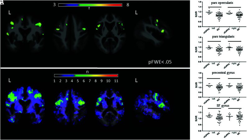 FIG 14.