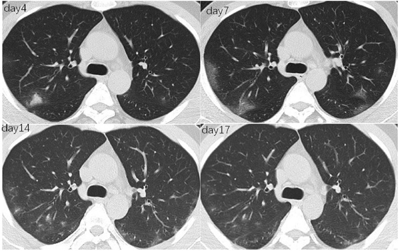 Fig. 1