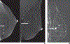 Fig. 3—
