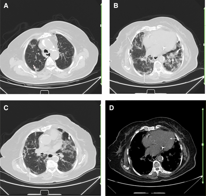 Fig. 4