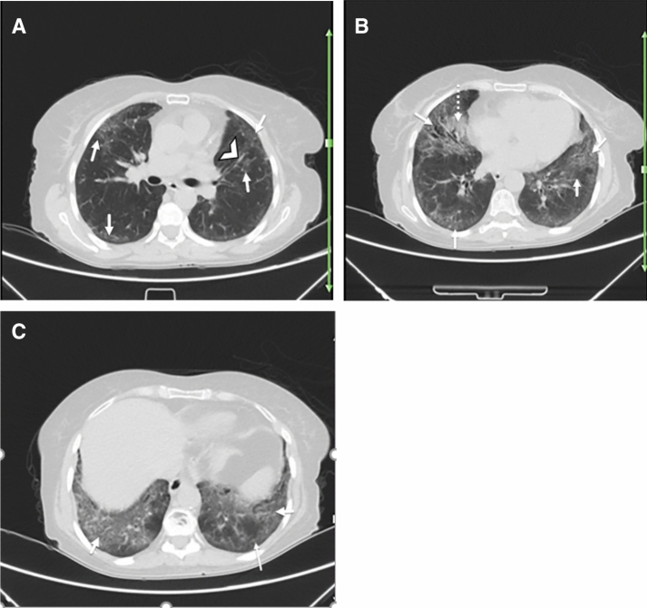 Fig. 1