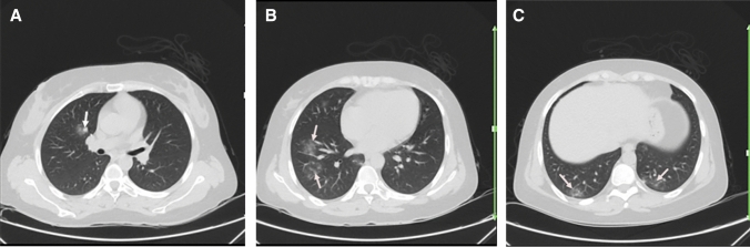 Fig. 3