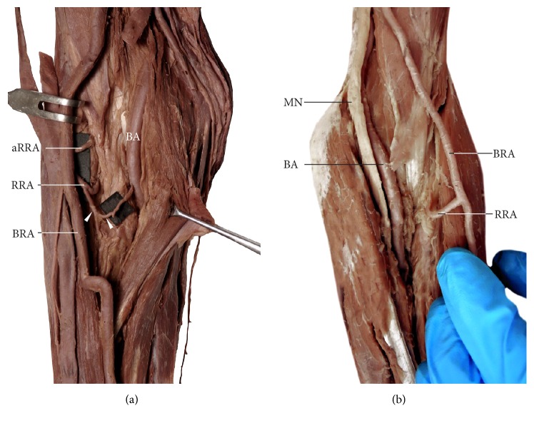 Figure 5