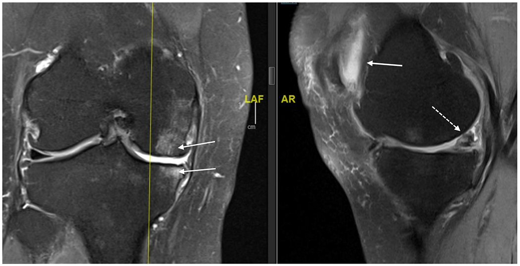 Figure 1B: