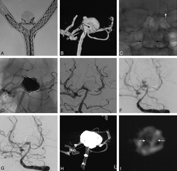 Fig 4.