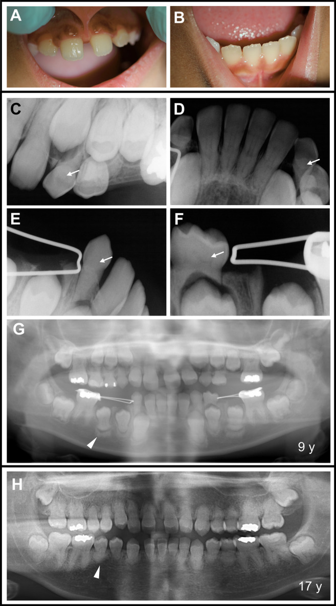 Fig 6