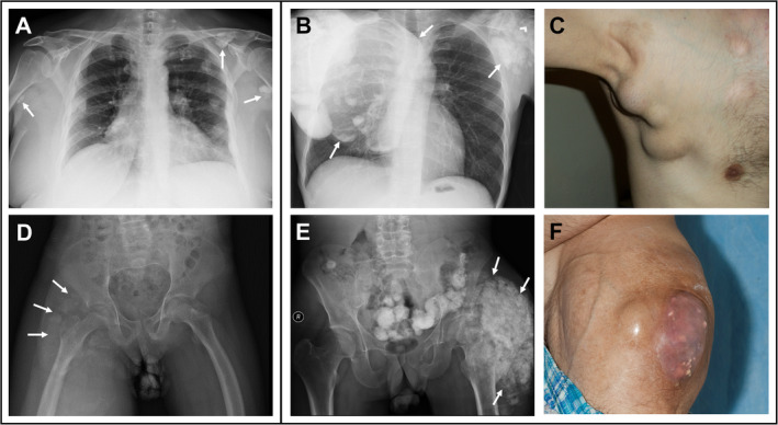 Fig 2