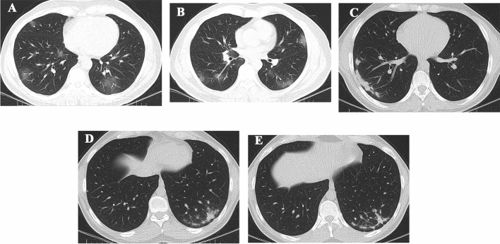 Fig. 2