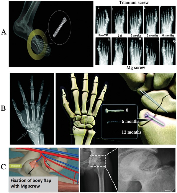 Figure 11