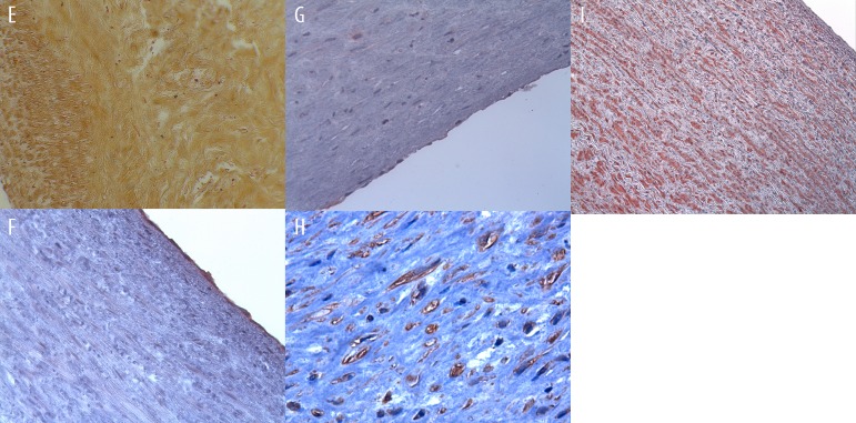 Figure 3E–I