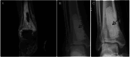 Figure 15
