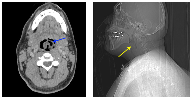 graphic file with name jetem-7-1-v18f1.jpg