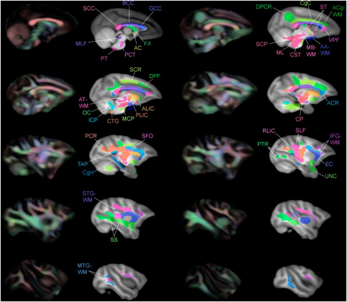 Figure 16