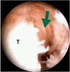 Fig. (1A)
