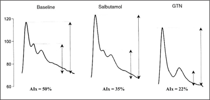 Figure 4)