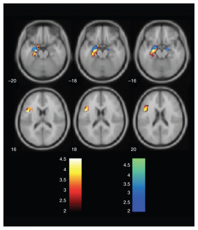 Fig. 2